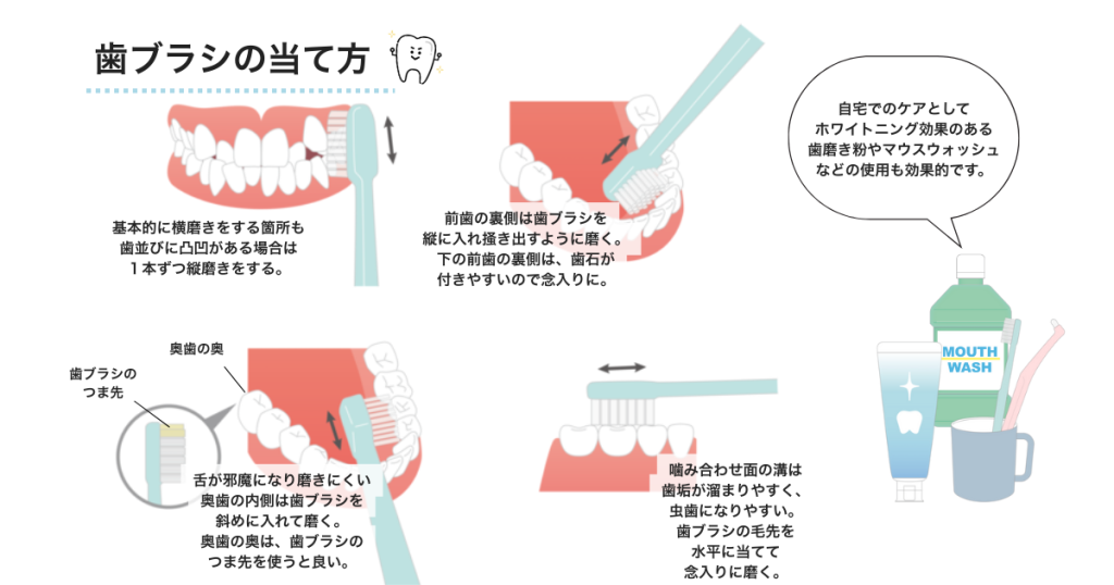 歯の黄ばみを防ぐセルフケアアイテム|ホワイトニング歯磨き粉と正しいブラッシング