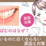 歯が黄ばむのはなぜ？磨いてるのに白くならない原因と対策まとめ