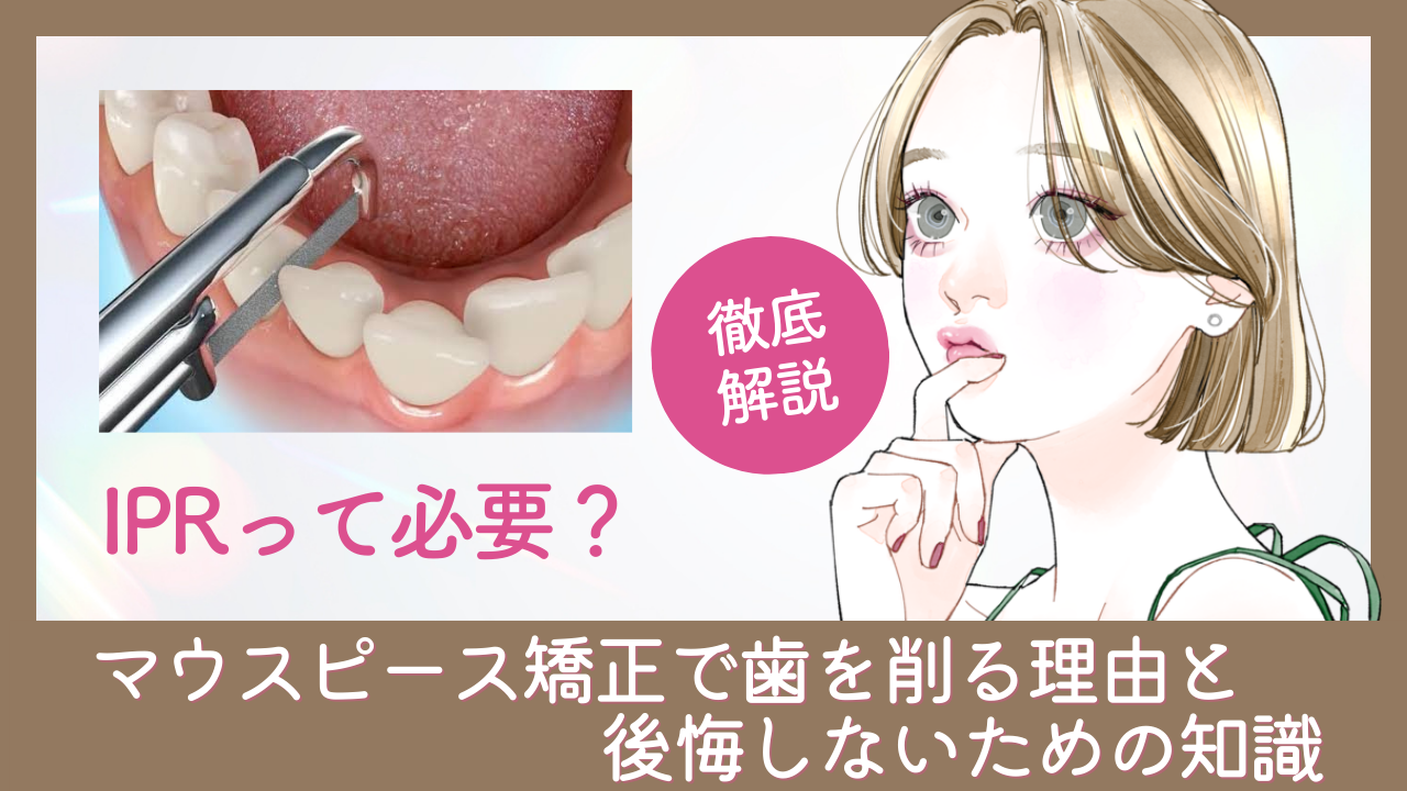 IPRって必要？マウスピース矯正で歯を削る理由と後悔しないための知識