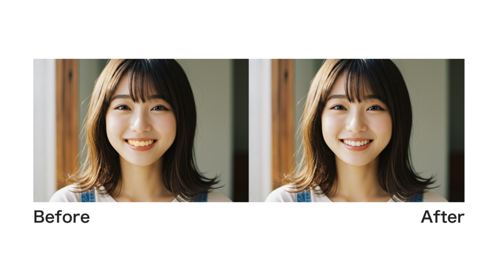 歯並びの変化による印象の違い｜矯正前と矯正後の比較