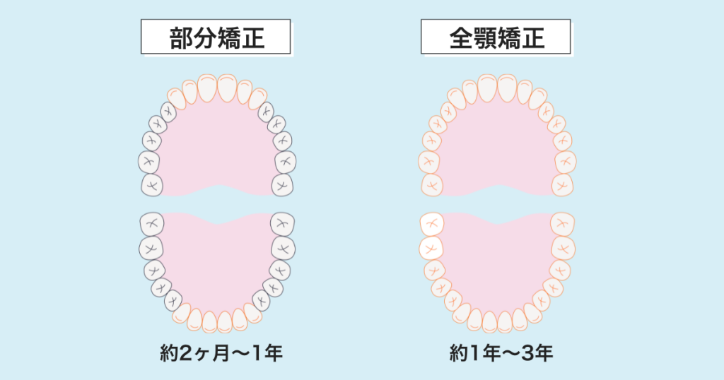 マウスピース矯正