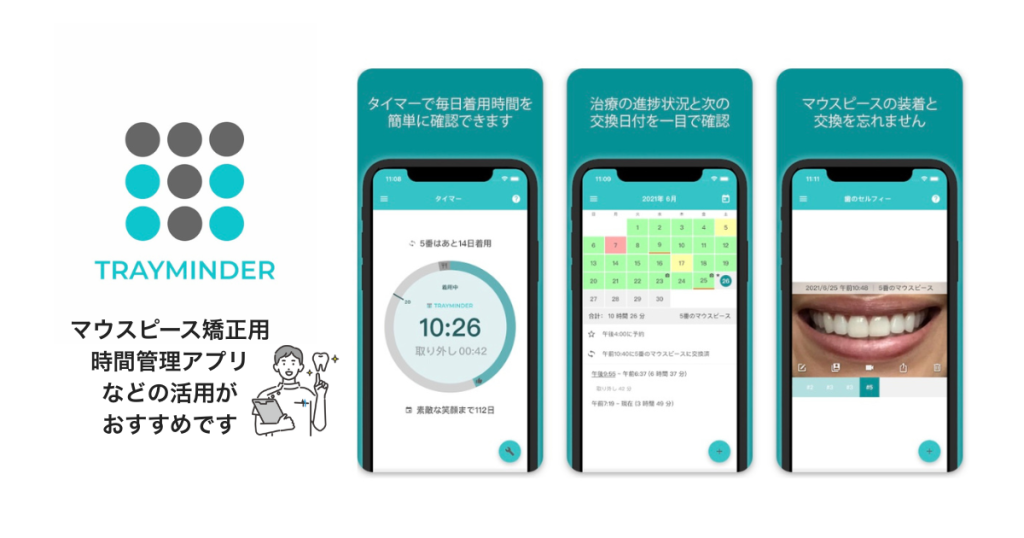 マウスピース装着時間を記録するスマホアプリの使用画面