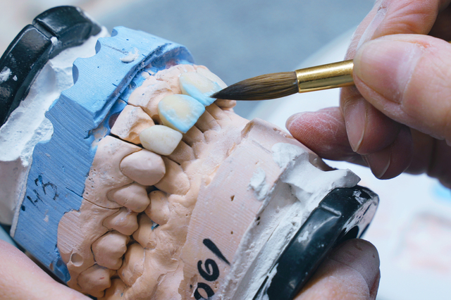 セラミッククラウンを技工所で製作する工程のイメージ画像