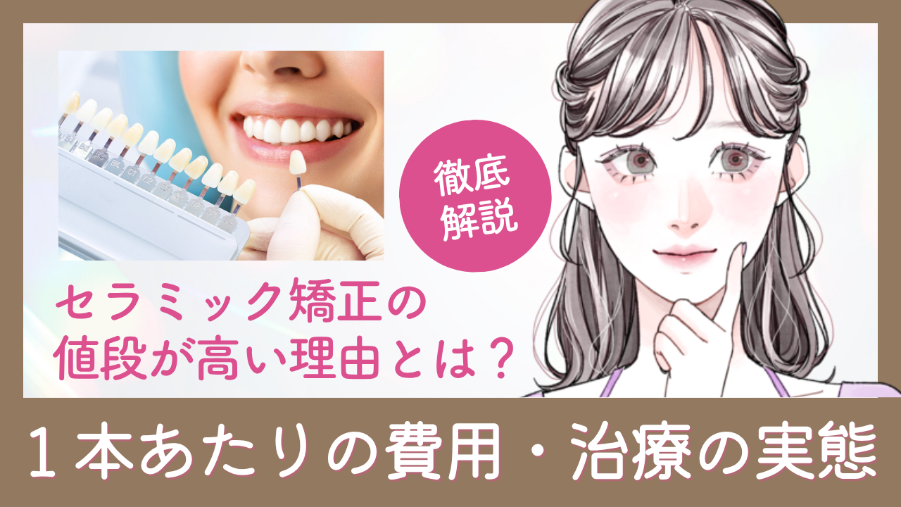 セラミック矯正の値段が高い理由とは？1本あたりの費用・治療の実態