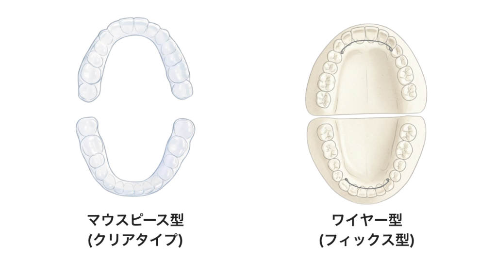 透明なマウスピース型リテーナーとワイヤー固定式リテーナーの違い