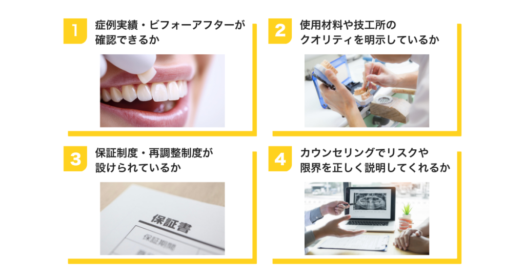 ラミネートべニアクリニックを選ぶ際のチェックポイント図解