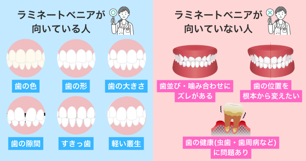 ラミネートべニアが向いている症例と向かない症例の比較図