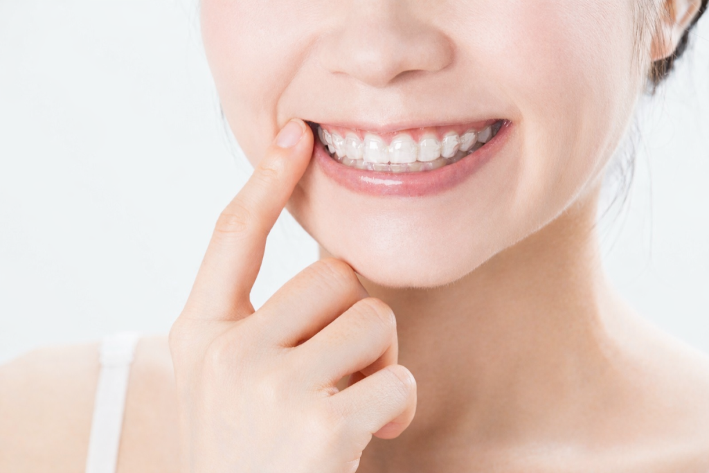 マウスピース矯正の装置イメージ|目立ちにくい歯列矯正