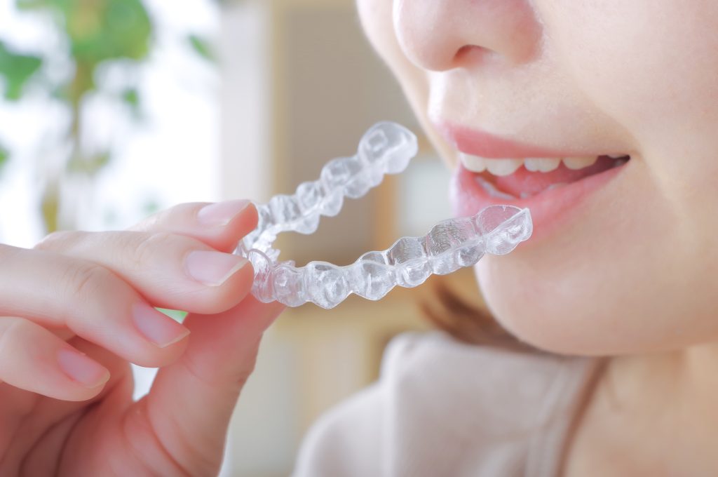 マウスピース矯正で後悔しやすい理由｜装着時間と自己管理
